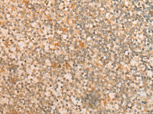 Anti-CFHR2 Rabbit Polyclonal Antibody