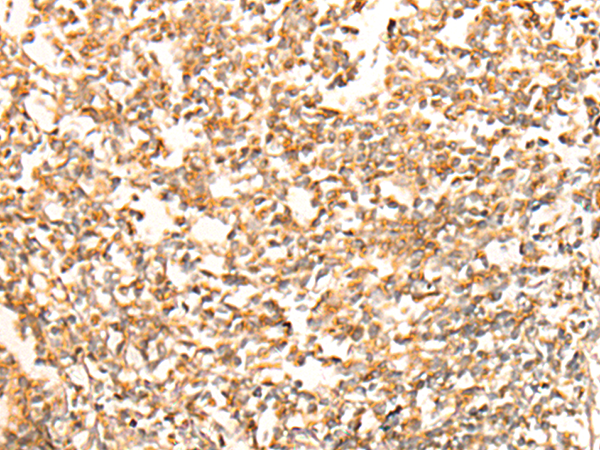 Anti-CHCHD3 Rabbit Polyclonal Antibody