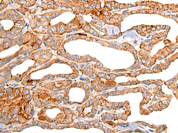 Anti-CHIT1 Rabbit Polyclonal Antibody