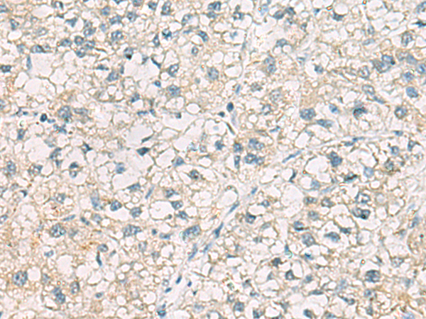 Anti-CHMP6 Rabbit Polyclonal Antibody