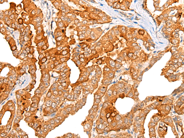 Anti-CHRD Rabbit Polyclonal Antibody