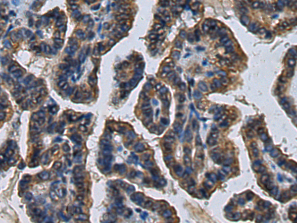 Anti-CHST10 Rabbit Polyclonal Antibody