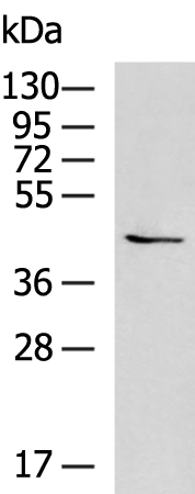 Anti-CHST10 Rabbit Polyclonal Antibody