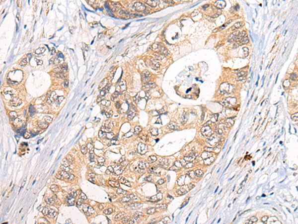 Anti-CLPTM1 Rabbit Polyclonal Antibody