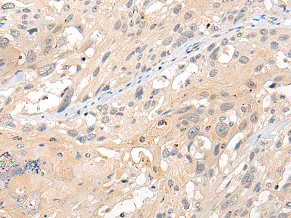 Anti-CMPK1 Rabbit Polyclonal Antibody