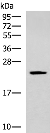 Anti-CMPK1 Rabbit Polyclonal Antibody