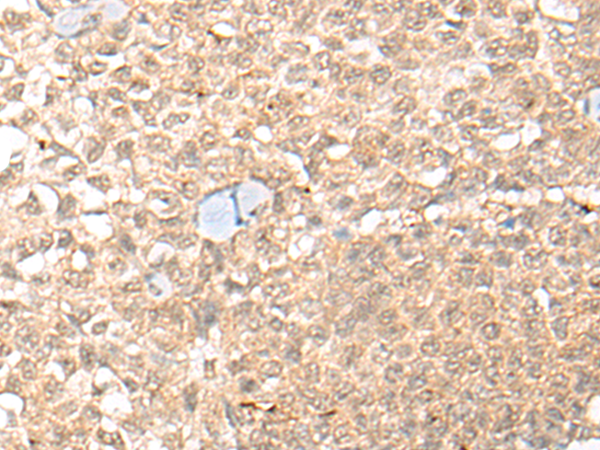 Anti-COMMD1 Rabbit Polyclonal Antibody