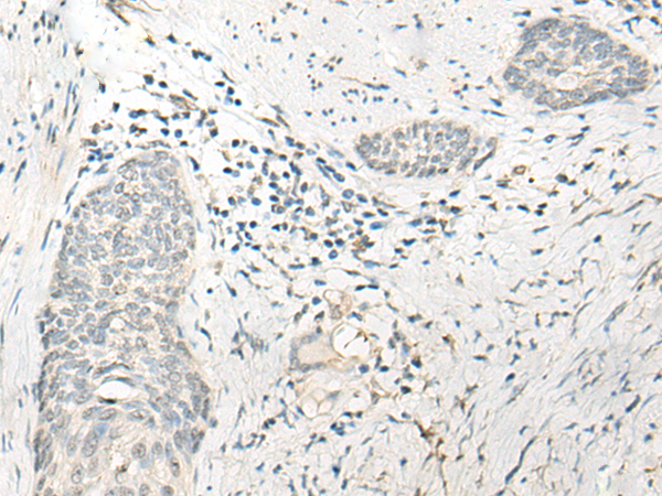 Anti-NR1I3 Rabbit Polyclonal Antibody