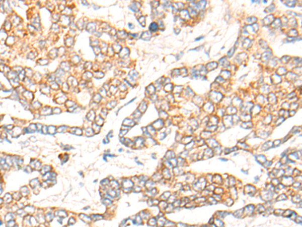 Anti-COPS6 Rabbit Polyclonal Antibody