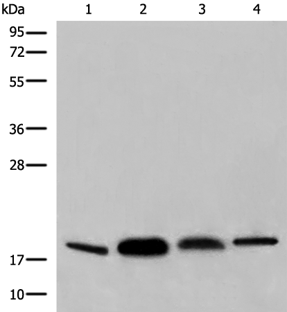 Anti-COPZ1 Rabbit Polyclonal Antibody