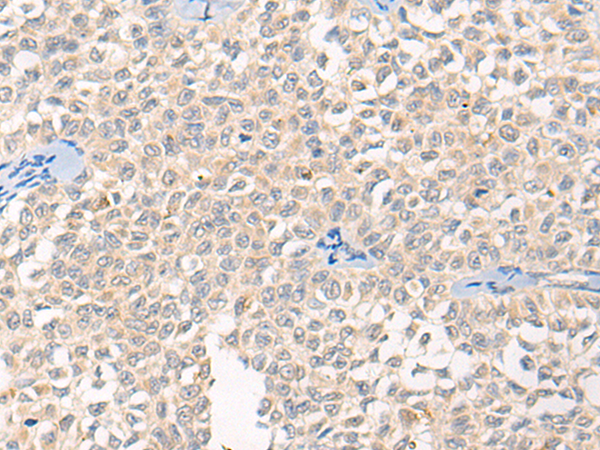 Anti-RCOR3 Rabbit Polyclonal Antibody