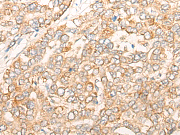 Anti-CORO7 Rabbit Polyclonal Antibody