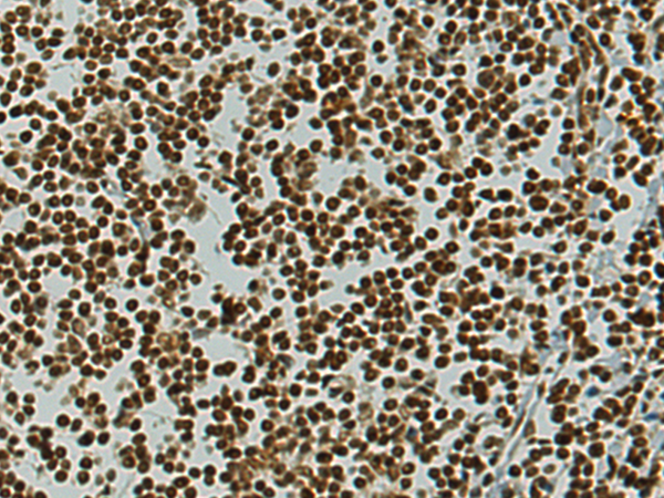 Anti-MIER1 Rabbit Polyclonal Antibody