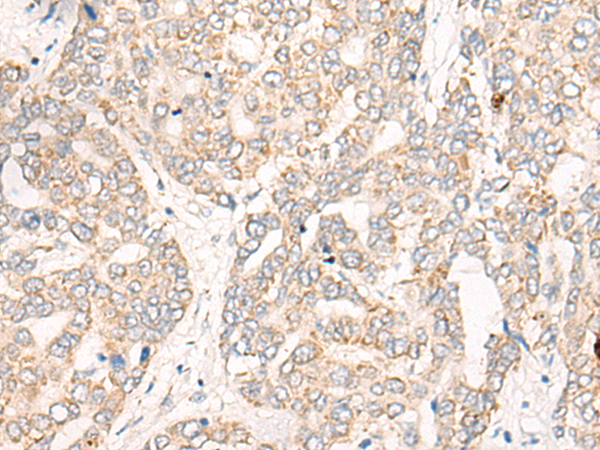 Anti-CREB3L2 Rabbit Polyclonal Antibody