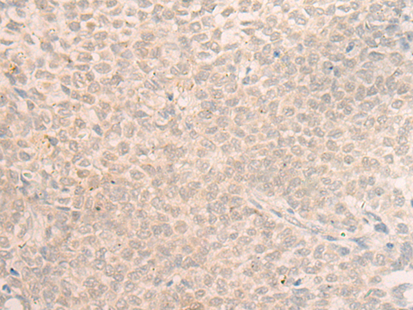 Anti-TKFC Rabbit Polyclonal Antibody