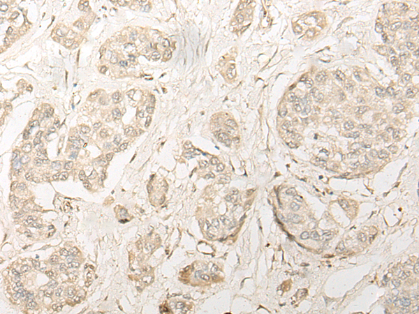 Anti-DDX1 Rabbit Polyclonal Antibody