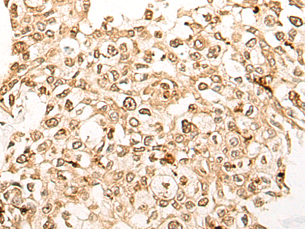 Anti-DDX27 Rabbit Polyclonal Antibody