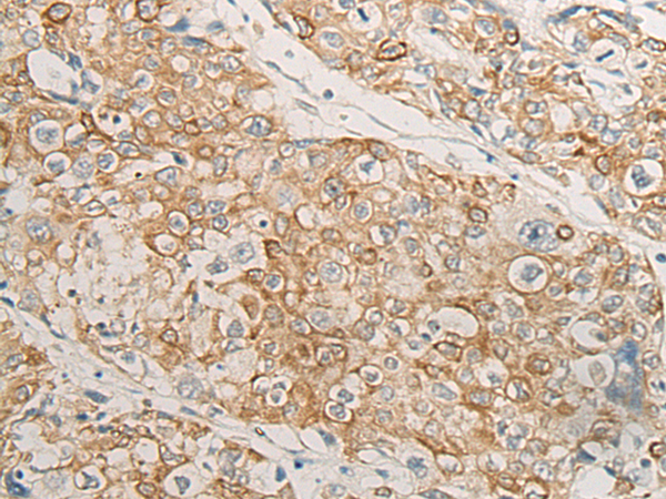 Anti-HLA DMB Rabbit Polyclonal Antibody
