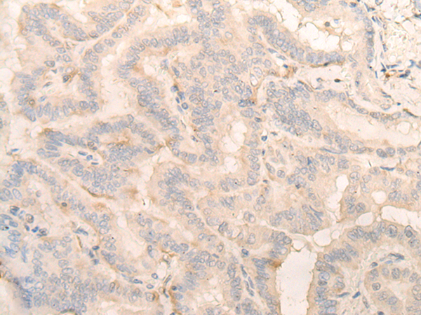 Anti-PITPNB Rabbit Polyclonal Antibody