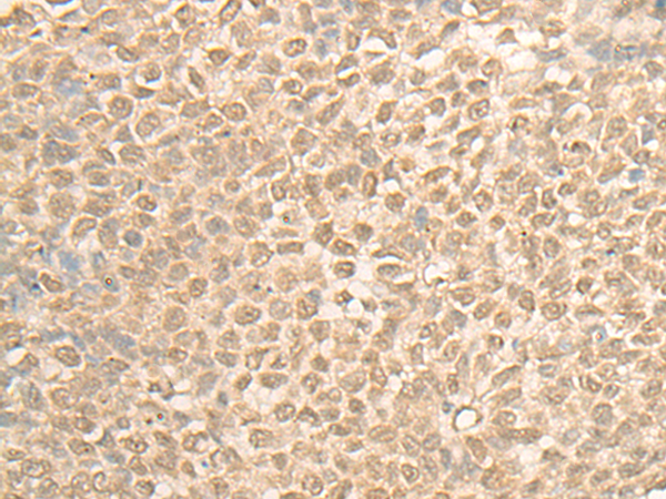 Anti-RSU1 Rabbit Polyclonal Antibody