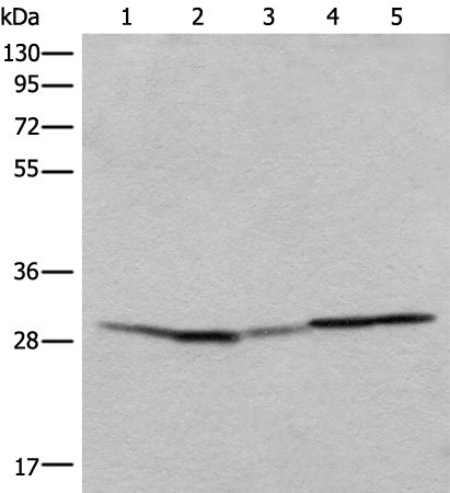 Anti-RSU1 Rabbit Polyclonal Antibody