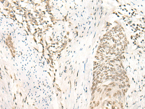 Anti-NIFK Rabbit Polyclonal Antibody