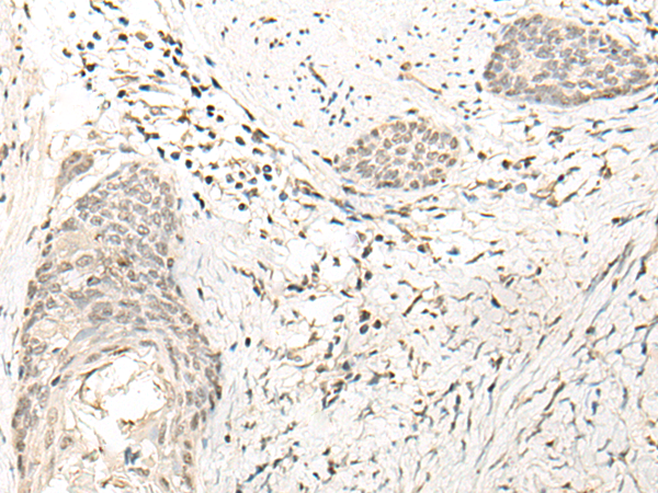 Anti-UBXN1 Rabbit Polyclonal Antibody