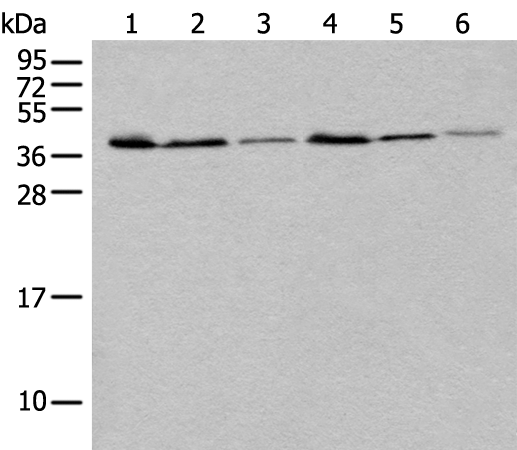 Anti-UBXN1 Rabbit Polyclonal Antibody