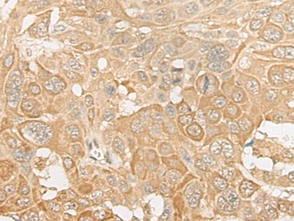 Anti-ROM1 Rabbit Polyclonal Antibody