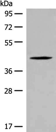 Anti-QTRT1 Rabbit Polyclonal Antibody