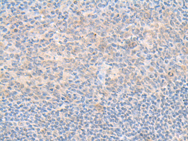 Anti-Spermine Synthase Rabbit Polyclonal Antibody