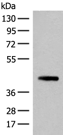 Anti-Spermine Synthase Rabbit Polyclonal Antibody