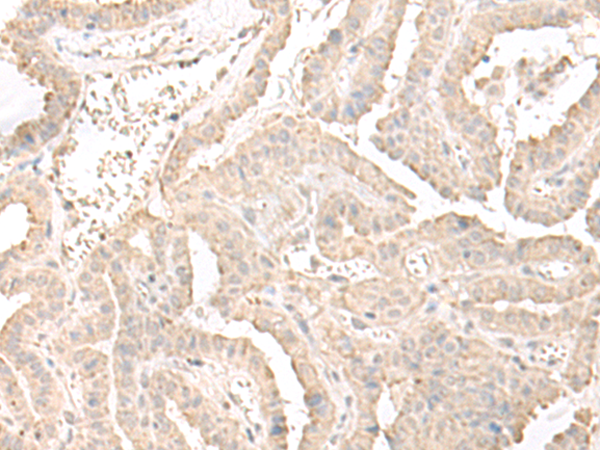 Anti-ERGIC3 Rabbit Polyclonal Antibody