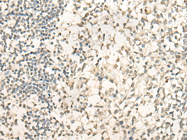 Anti-NEIL1 Rabbit Polyclonal Antibody