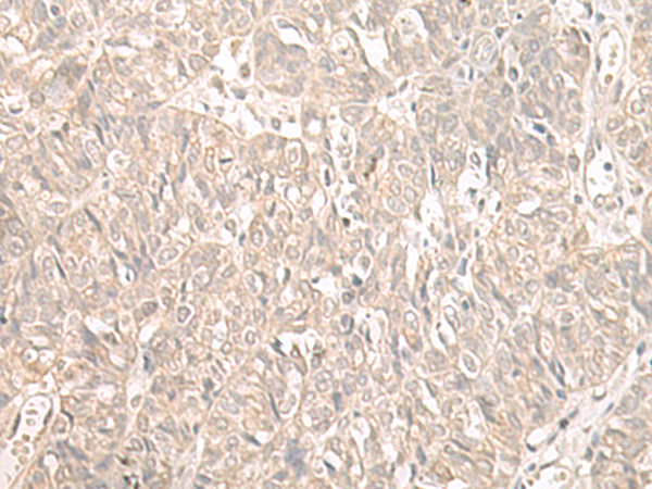 Anti-ILKAP Rabbit Polyclonal Antibody