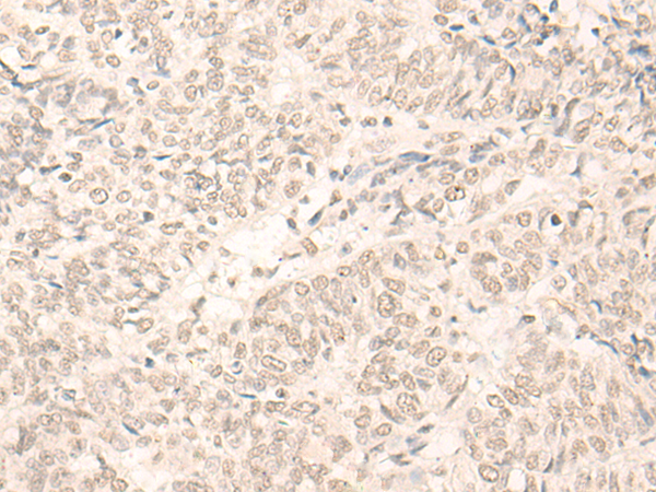 Anti-SPF45 Rabbit Polyclonal Antibody