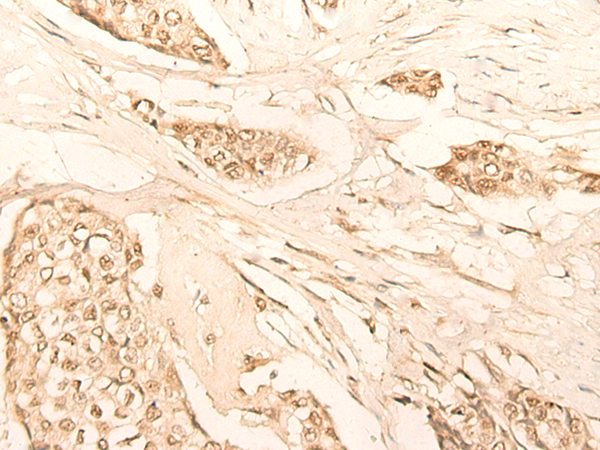 Anti-KLHDC2 Rabbit Polyclonal Antibody