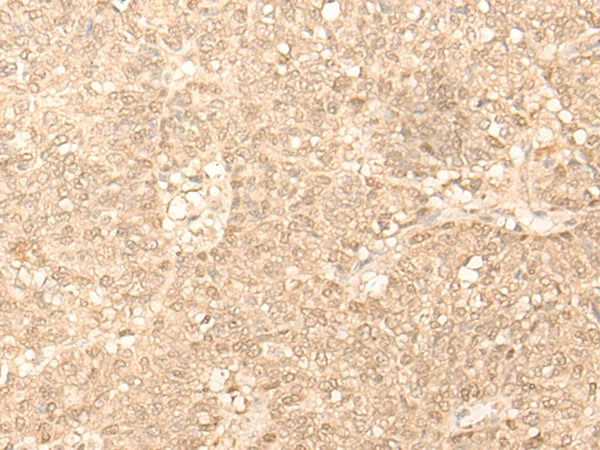 Anti-FAH Rabbit Polyclonal Antibody