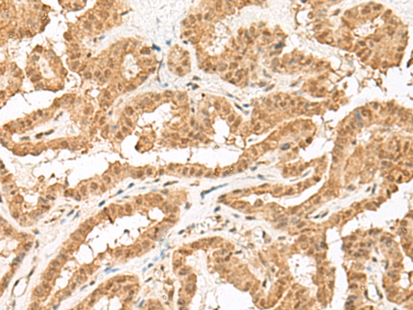 Anti-ZBTB8A Rabbit Polyclonal Antibody