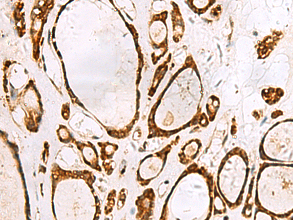 Anti-GRWD1 Rabbit Polyclonal Antibody