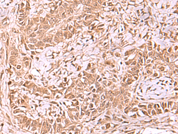 Anti-RUVBL1 Rabbit Polyclonal Antibody