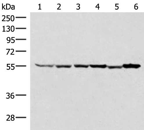 Anti-RUVBL1 Rabbit Polyclonal Antibody