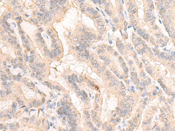 Anti-SELENBP1 Rabbit Polyclonal Antibody