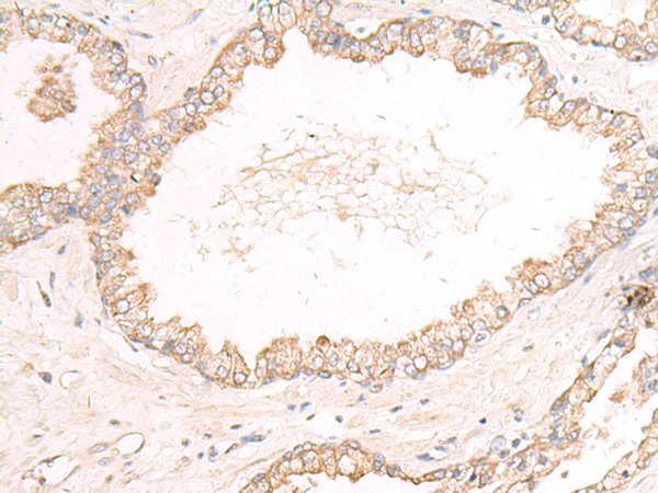 Anti-PARS2 Rabbit Polyclonal Antibody