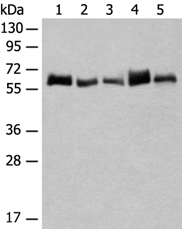 Anti-CCDC47 Rabbit Polyclonal Antibody
