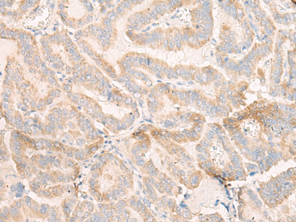 Anti-SHMT2 Rabbit Polyclonal Antibody