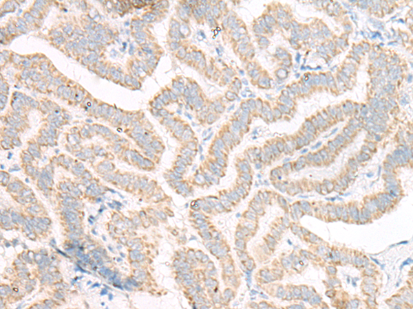 Anti-ACSF2 Rabbit Polyclonal Antibody