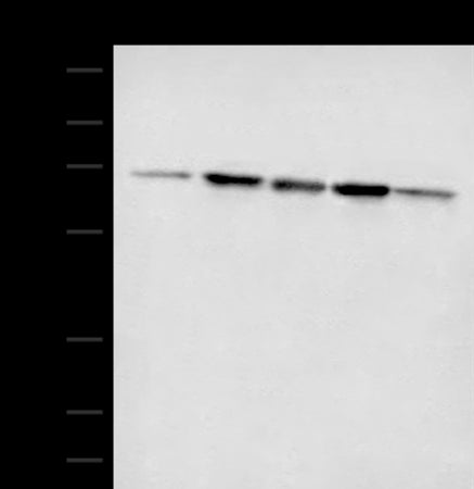 Anti-ACSF2 Rabbit Polyclonal Antibody