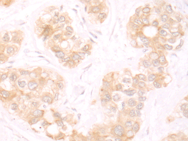 Anti-TRMT1 Rabbit Polyclonal Antibody