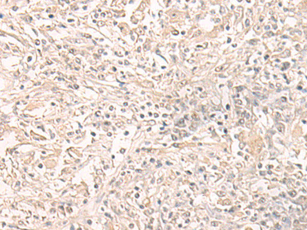 Anti-Thimet Oligopeptidase Rabbit Polyclonal Antibody